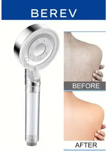 Berev Filtreli 5 Fonksiyonlu Krom Yüksek Basınçlı Duş Başlığı Özellikleri ve Kullanıcı Yorumları